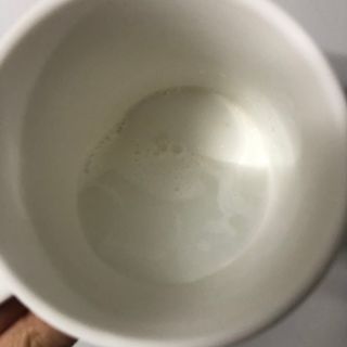 썸헤어 / SUMHAIR 썸헤어 헤어링 앰플 2종 중 택1 — 5점을 준 리뷰어가 2021년 4월 올린 사용 사진