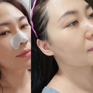 세뚜아(Cettua) 세뚜아 스티키 포어 패치 Cettua Sticky Pore Patch — 4점을 준 리뷰어가 2023년 9월 올린 사용 사진