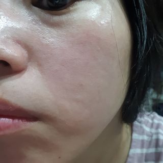 에센느 닥터 멜라닌 화이트닝 앰플 — 5점을 준 리뷰어가 2023년 4월 올린 사용 사진
