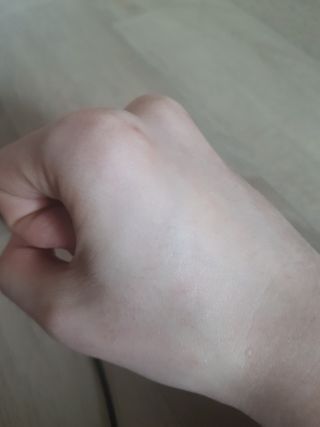 히루스카 포스트아크네 클리어 — 4점을 준 리뷰어가 2021년 1월 올린 사용 사진