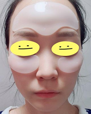 아이디플라코스메틱 아이디 페이스핏 플러스 패치 v2 — 5점을 준 리뷰어가 2020년 12월 올린 사용 사진
