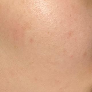 스킨큐어 산다화 비타민c 화이트닝 에센스 30ml — 5점을 준 리뷰어가 2023년 9월 올린 사용 사진