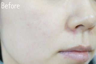 더마포레스트 마데카소사이드 리페어 크림 / 캐비아추출물 병풀추출물 시카케어 미백 주름개선 — 5점을 준 리뷰어가 2021년 7월 올린 사용 사진