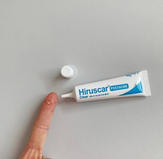 히루스카 포스트아크네 클리어 — 5점을 준 리뷰어가 2021년 1월 올린 사용 사진