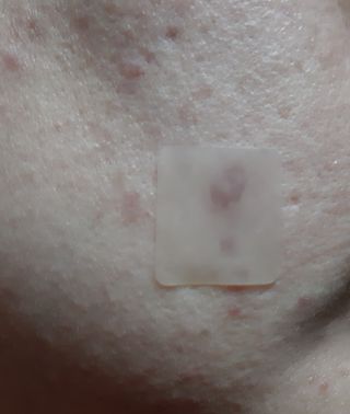 [큐어반H 커팅] 간편하게 떼서 쓰는 자외선차단 습윤밴드 (1팩/30매입) — 5점을 준 리뷰어가 2022년 11월 올린 사용 사진