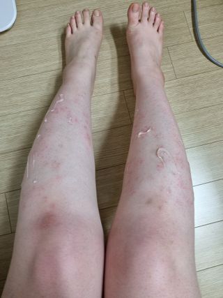 브에노 스킨셀 더마 앰플 — 4점을 준 리뷰어가 2021년 7월 올린 사용 사진