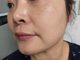나우_ [리브엠]피부 속부터 겹겹이, 촘촘하게! 워터핏8중 수분착붙 크림 — 5점을 준 리뷰어가 2025년 1월 올린 사용 사진