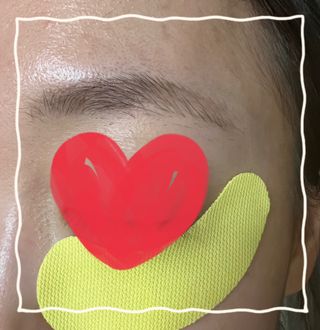세뚜아(Cettua) [세뚜아] 비타풀 아이 패치 Cettua Vita-Full Eye Patch — 3.5점을 준 리뷰어가 2023년 8월 올린 사용 사진