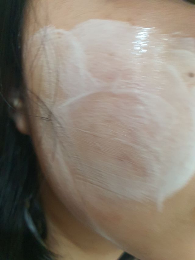 팜스테이 티트리 바이옴 카밍 아크네 폼 리뷰 사진