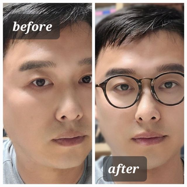 라솔 에이지 리뉴 퍼펙트 세럼 리뷰 사진