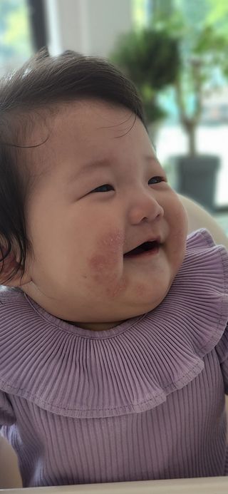 젠바이오 코스메틱스 젠바이오수딩크림]   가려운 피부 & 아토피 원픽 크림 — 5점을 준 리뷰어가 2022년 9월 올린 사용 사진