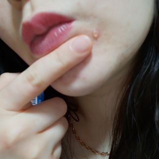 히루스카 포스트아크네 클리어 — 5점을 준 리뷰어가 2021년 2월 올린 사용 사진