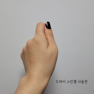 바이오오일 [바이오-오일] 드라이 스킨 젤 100ml — 5점을 준 리뷰어가 2021년 10월 올린 사용 사진