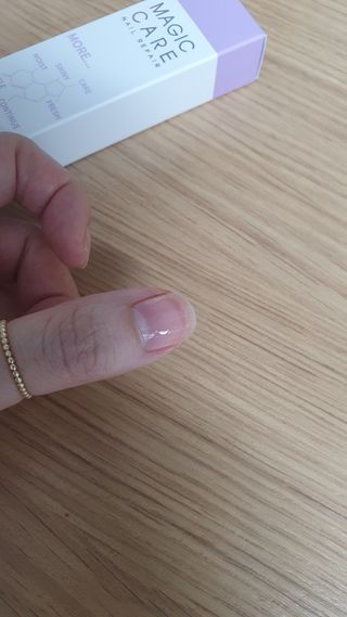 뷰젤 매직케어 네일솔루션 손발톱 보습 영양제 펜슬타입 5ml — 5점을 준 리뷰어가 2022년 3월 올린 사용 사진