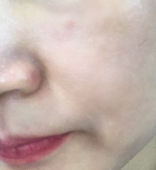 코드네이처 비아미 시카 더블 앰플 — 3.5점을 준 리뷰어가 2021년 5월 올린 사용 사진