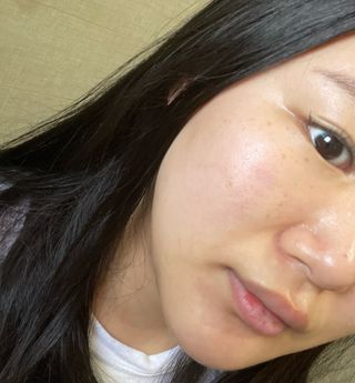 [스킨1004] 마다가스카르 센텔라 앰플 100ml — 5점을 준 리뷰어가 2024년 6월 올린 사용 사진