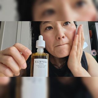 MF[스킨1004] 마다가스카르 센텔라 앰플 100ml — 4점을 준 리뷰어가 2024년 5월 올린 사용 사진