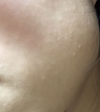 셀바이져 지우개 미스트 피부 보호 입주변 트러블 진정 케어 아기 안개분사 미스트 — 5점을 준 리뷰어가 2021년 2월 올린 사용 사진