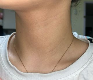 바노바기 코스메틱 피디알엔 리페어 리얼 밤 9g — 5점을 준 리뷰어가 2023년 10월 올린 사용 사진