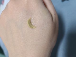 건선/아토/습진/민감성 피부 천연보습진정크림 소리온 크림 & 센시티브 크림 50g — 4점을 준 리뷰어가 2022년 2월 올린 사용 사진