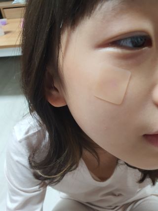 [큐어반H 커팅] 간편하게 떼서 쓰는 자외선차단 습윤밴드 (1팩/30매입) — 5점을 준 리뷰어가 2022년 11월 올린 사용 사진