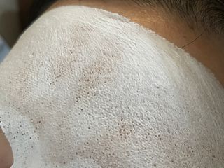 아이디플라코스메틱 페이스핏 플라스터 마스크 _ 리뉴얼 — 5점을 준 리뷰어가 2022년 4월 올린 사용 사진