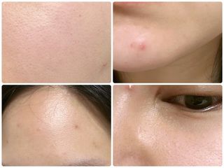 바노바기 코스메틱 바노바기 밀크 씨슬 스킨 리페어링 스타터 키트 — 5점을 준 리뷰어가 2024년 1월 올린 사용 사진