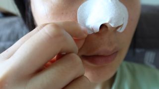 세뚜아(Cettua) 세뚜아 스티키 포어 패치 Cettua Sticky Pore Patch — 4점을 준 리뷰어가 2023년 8월 올린 사용 사진