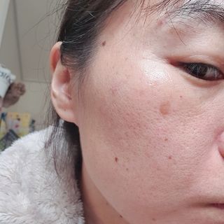 난나 살몬 스파이더 검버섯 미백 톤업 화이트닝 연어 앰플 크림 300ml 대용량 — 5점을 준 리뷰어가 2022년 11월 올린 사용 사진