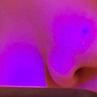 메데스 비츠케어 모공케어 피부관리키트 — 3점을 준 리뷰어가 2021년 7월 올린 사용 사진