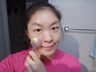 퍼퓸홀릭 [보툴리늄 원액] 7일의 변화 메디-보툴리늄 — 5점을 준 리뷰어가 2021년 9월 올린 사용 사진
