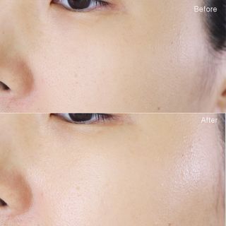 로자펠로 시카 앰플 50ml EGF 재생 미백 비타민 — 5점을 준 리뷰어가 2021년 2월 올린 사용 사진