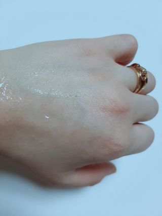 셀바이져 지우개 미스트 피부 보호 입주변 트러블 진정 케어 아기 안개분사 미스트 — 5점을 준 리뷰어가 2021년 3월 올린 사용 사진