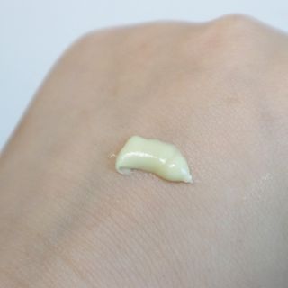 건선/아토/습진/민감성 피부 천연보습진정크림 소리온 크림 & 센시티브 크림 50g — 5점을 준 리뷰어가 2022년 1월 올린 사용 사진