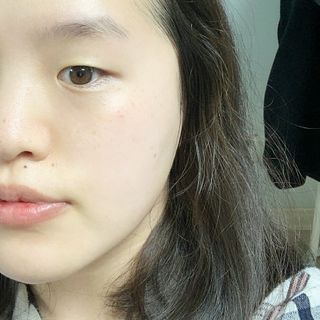 메디필 레드 락토 콜라겐 필링패드 — 5점을 준 리뷰어가 2021년 3월 올린 사용 사진