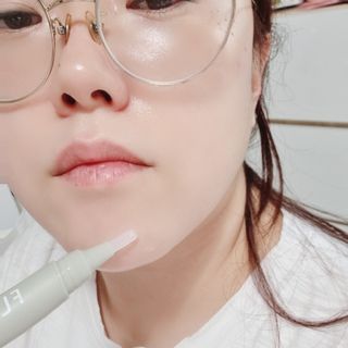 플리프 시카 알로에 스팟키트 — 5점을 준 리뷰어가 2021년 2월 올린 사용 사진