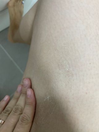 바이오오일 [바이오-오일] 드라이 스킨 젤 100ml — 4점을 준 리뷰어가 2021년 6월 올린 사용 사진