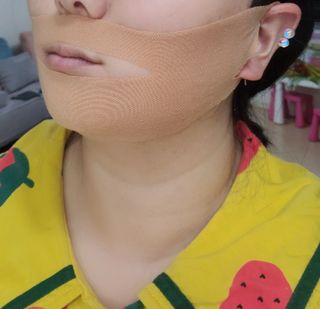 아이디플라코스메틱 아이디 페이스핏 마이너스 밴드 v2 — 5점을 준 리뷰어가 2021년 5월 올린 사용 사진