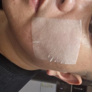 [후르디아] 화난피부 급속진정 AC 클리어 패드 (개별포장 50매) — 5점을 준 리뷰어가 2024년 4월 올린 사용 사진