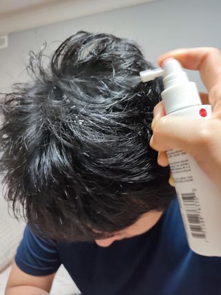 안티닷프로 두피케어 샴푸 — 5점을 준 리뷰어가 2022년 7월 올린 사용 사진