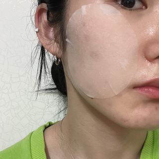 랑벨 랑바이오 블랙 시카 퀵 패드 100매 (3초 쿨링/3분 흡수, 블랙비 프로폴리스/시카 4종 함유, 대용량) — 4점을 준 리뷰어가 2022년 3월 올린 사용 사진