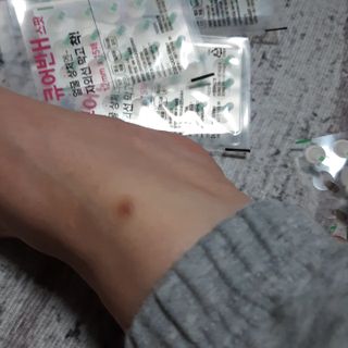 [큐어반H 스팟] 자외선 99프로 차단되는 스틱타입 스팟밴드(1팩 / 66매입) — 5점을 준 리뷰어가 2022년 11월 올린 사용 사진