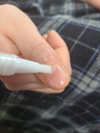 뷰젤 매직케어 네일솔루션 손발톱 보습 영양제 펜슬타입 5ml — 5점을 준 리뷰어가 2022년 3월 올린 사용 사진