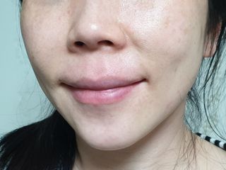 리더스코스메틱 리더스 카밍 바이오틱스 퀵 수딩 패드 — 5점을 준 리뷰어가 2022년 4월 올린 사용 사진