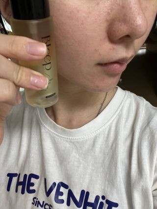 [쿠팡] 블립 수분 알로에 페이스 얼굴 진정 앰플 안개분사 미스트 스프레이 세럼, 50ml, 1개 — 5점을 준 리뷰어가 2024년 11월 올린 사용 사진