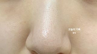 세뚜아(Cettua) 세뚜아 스티키 포어 패치 Cettua Sticky Pore Patch — 5점을 준 리뷰어가 2023년 8월 올린 사용 사진