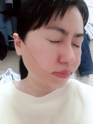 아이디플라코스메틱 아이디 페이스핏 마이너스 밴드 v2 — 5점을 준 리뷰어가 2021년 6월 올린 사용 사진