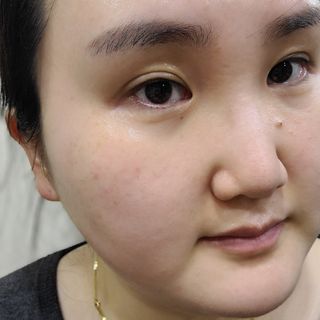 셀바이져 지우개 미스트 피부 보호 입주변 트러블 진정 케어 아기 안개분사 미스트 — 5점을 준 리뷰어가 2021년 3월 올린 사용 사진