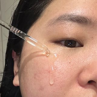 [스킨1004] 마다가스카르 센텔라 앰플 100ml — 5점을 준 리뷰어가 2024년 5월 올린 사용 사진