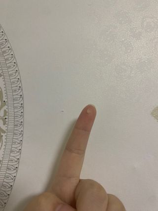 히루스카 포스트아크네 클리어 — 5점을 준 리뷰어가 2020년 12월 올린 사용 사진